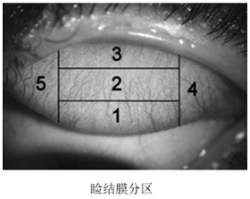 接觸鏡護(hù)理產(chǎn)品注冊審查指導(dǎo)原則（2023年修訂版）（2023年第9號(hào)）(圖7)
