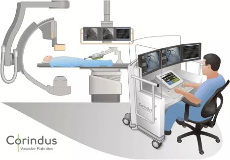 血管腔內(nèi)介入手術(shù)機(jī)器人首例臨床試驗(yàn)案例及未來(lái)發(fā)展方向(圖2) 血管腔內(nèi)介入手術(shù)機(jī)器人首例臨床試驗(yàn)案例及未來(lái)發(fā)展方向(圖2)